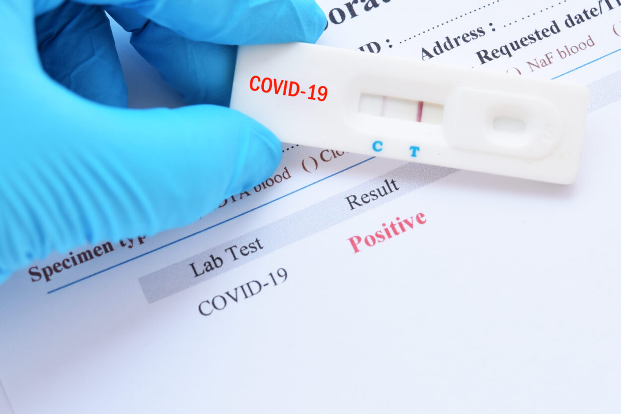 Природный иммунитет на COVID-19: ученые начали изучать феномен людей, устойчивых к коронавирусу
