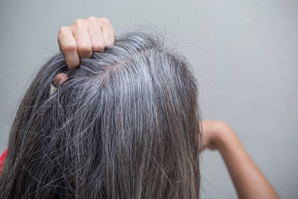 Почему у пожилых людей седеют волосы?