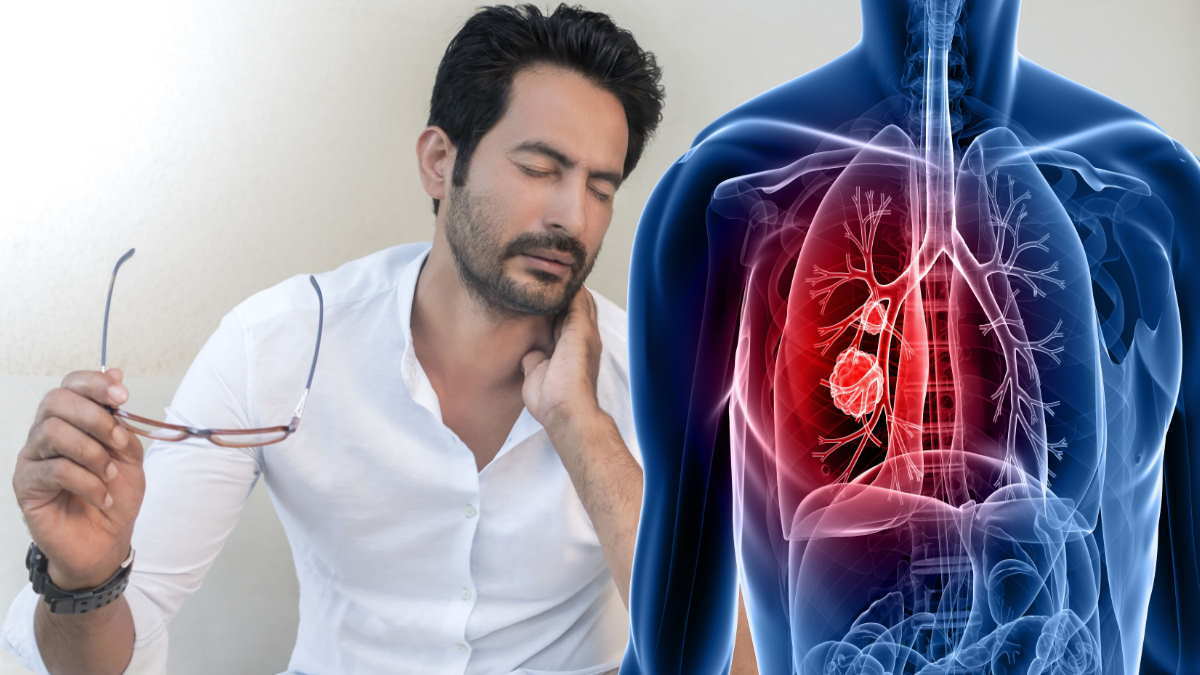 Рак легень помолодшав: лікарі назвали кілька симптомів, які мають сильно насторожити