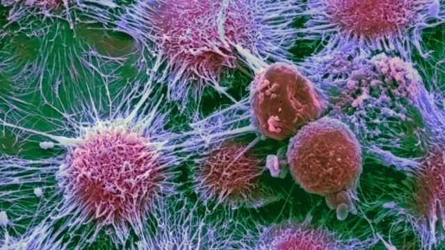 Рак может возникать случайно: ученые могут объяснить лишь 40% всех случаев
