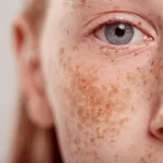 ластовиння