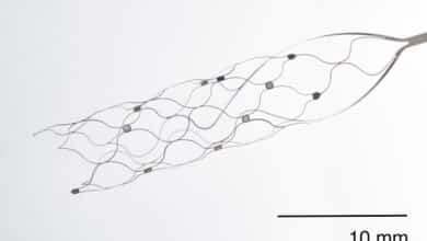 Stentrode