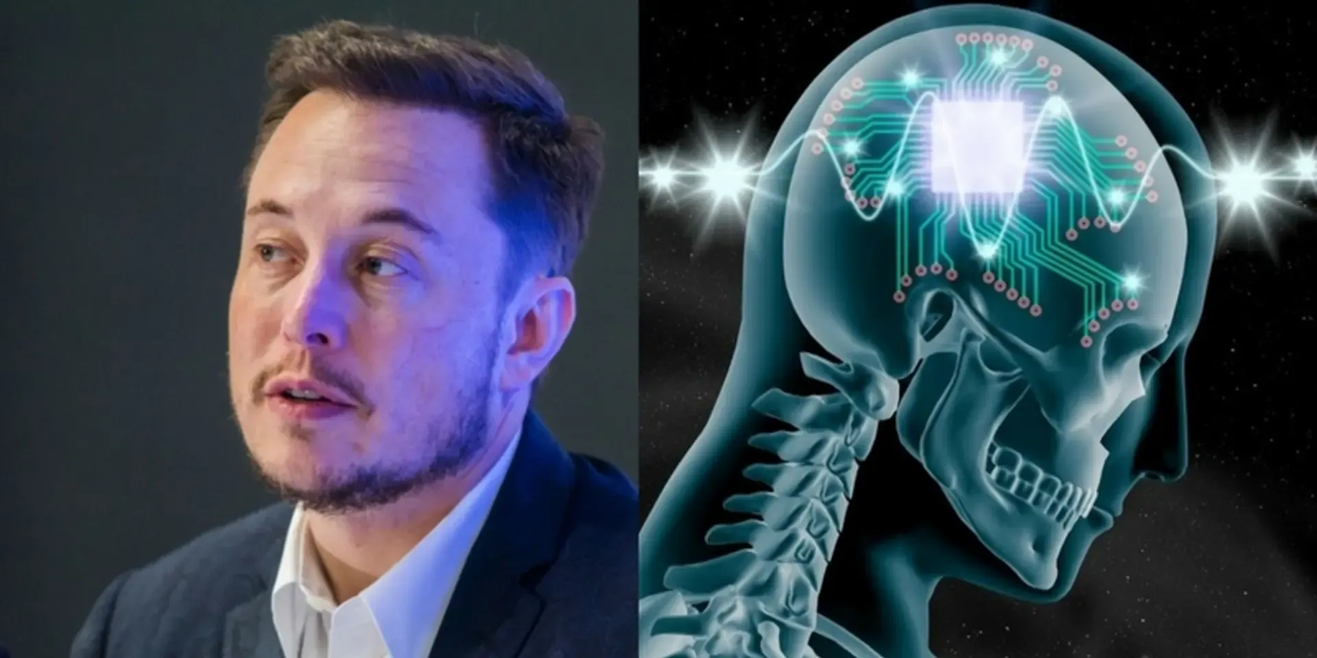Neuralink дозволила людині розмовляти телефоном силою думки: імплант також навчили керувати ШІ